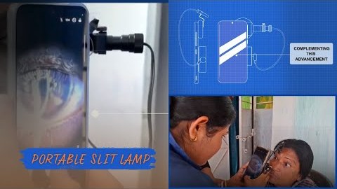 Video thumbnail: Bringing Advanced Eye Care Closer To Every Community
